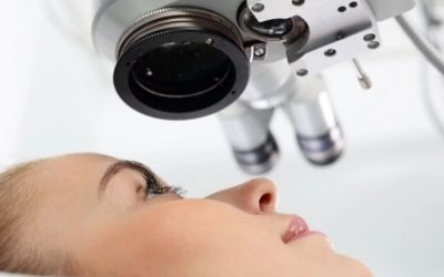 ¿Qué saber sobre la cirugía para tratar el astigmatismo?