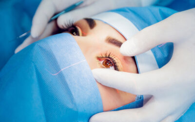 Cirugía laser de ojos: ¿es para mi?
