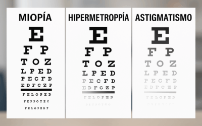Diferencias entre miopía, hipermetropía y astigmatismo: guía completa 2025